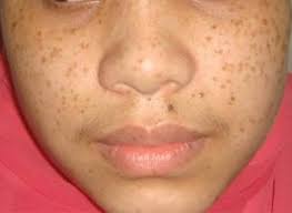 Skin Specialist Prof.Dr.Hasibur Rahman