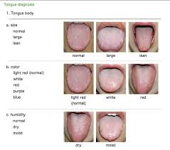 Tongue Diagnosis Doctor Natureyoga