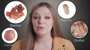 After starting treatment, she now wakes up with clearer skin. What Triggers Rosacea And How To Treat It Allure