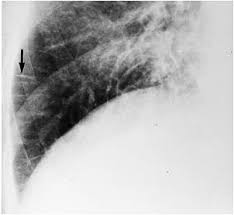 Built by trivia lovers for trivia lovers, this free online trivia game will test your ability to separate fact from fiction. Radiology Test 1 Proprofs Quiz