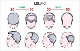 August 12, 2018august 11, 2018 by nor hanis ismail. Lebatkan Rambut Dengan Feryal Argan Oil 3 Fakta Rambut Gugur Yang Anda Perlu Tahu Fakta 1 Kira Kira 70 Lelaki Dan Wanita Akan Menderita Masalah Keguguran Rambut Bila Mereka Mencapai Umur
