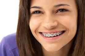 But what happens when those pearly white teeth have spots on them? How To Get Rid Of White Spots On Teeth After Braces