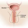 In both males and females, muscle (urethral sphincter) surrounds the urethra. 1