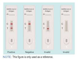 That diagnosis should be based on a pcr (molecular) test. Sars Cov 2 Antigen Rapid Test Kit Colloidal Gold A254381