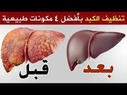 كوب واحد منه ينظف الكبد والجسم سيجعل كبدك جديدا وستبدو أصغر سنا وداعا لتراكم السموم في الكبد معجزة Y In 2021 Health Fitness Nutrition Healty Food Fitness Nutrition