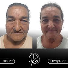 Dra. Vanessa Rodríguez| Cirugía Plástica y Reconstructiva  (@dra.rodriguezvanessa) · Maturín