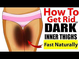 How To Lighten Your Dark Inner Thighs Naturally Lighten Inner Thighs Dark Spots On Skin Skin Spots