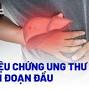viendongdaily.com + Dấu hiệu ung thư Gan from tamanhhospital.vn