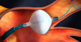 Making liquid nitrogen ice cream is easier than you think! Liquid Nitrogen Used In New Method For Treating Atrial Fibrillation