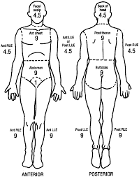 Faithful Rule Of Nines Diagram Rule Of 9s Burn Chart Child