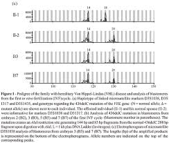 Scielo Brasil Preimplantation Genetic Diagnosis Of Von Hippel Lindau Disease Cancer Syndrome By Combined Mutation And Segregation Analysis Preimplantation Genetic Diagnosis Of Von Hippel Lindau Disease Cancer Syndrome By Combined Mutation And