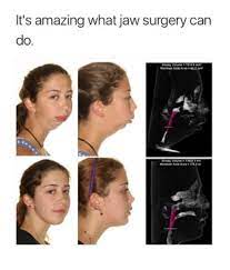 Maybe you would like to learn more about one of these? No Chin Meme Towels