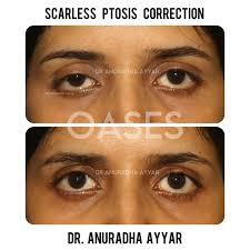 Image result for Blepharis transvaalensis