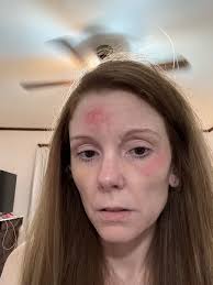 Fundraiser by Amy Jump : Support for Amy's medical procedures and housing.