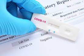 A comparticipação é limitada a um máximo de quatro testes por mês Teste Rapido Para Detectar Coronavirus E Criado Pela Usp Summit Saude