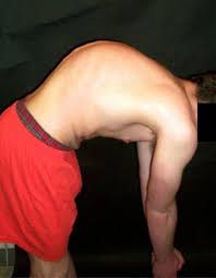 Image result for Low Back Standing Exam