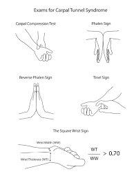 Image result for Carpal Compression Test