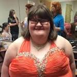  380-Pound Girl With Genetic Condition Wins Miss Amazing Pageant: What Is Prader-Willi Syndrome?