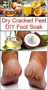 Apply some moisturizer if the skin is extremely dry after drying. Listerine Foot Sock Vinegar Feet Scrubs And Baths A Listly List