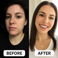 Aesthetics Before & After Photography Guidelines