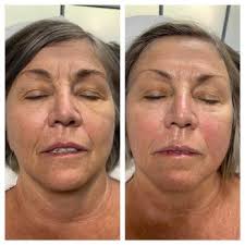 FOXY GLOW AESTHETICS