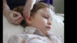 Pediatric Ambulatory EEG for Epilepsy and Seizure Disorders