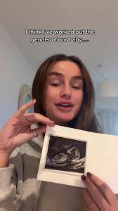 Understanding the Nub Theory for Baby Gender Prediction