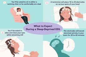 Types of sleep disorders include sleep deprivation, night walking, separation anxiety, and parasomnias. How A Sleep Deprived Eeg May Diagnose Seizures