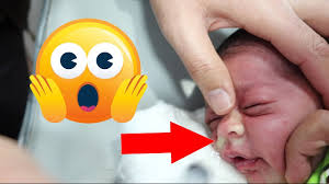 كمية مخاط فظيعة خرجت من انف الطفل يوسف بعد غسيل الانف مع طريقة لفه في البطانية Youtube