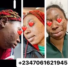 SKIN FIX BY SHERRYLGOLD