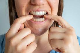 If you're interested in fixing crooked teeth without braces, you might consider treatment with removable clear aligners. Fixing A Crossbite You Don T Always Need Braces Byte