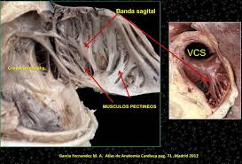 Auricle, flop of tissue that partially covers the atrium. Ma Garcia Fernandez On Twitter Anatomia De La Orejuela Derecha
