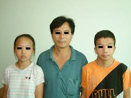 Image result for Webbed Neck