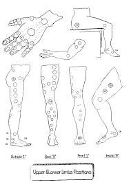 Where To Perform Hijama Or Cupping Hijama Or Cupping Details