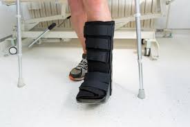 Md orthopaedics offers ponseti shoes for sale. Clubfoot Causes And Treatments