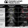 Here are some breast cancer ultrasound images: Https Encrypted Tbn0 Gstatic Com Images Q Tbn And9gcsn7ll 5m320zzgbjr2bg0kl975h7srys8r31suhswznlfuhf3t Usqp Cau