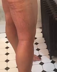 Why Do I Have Streaks In My Express Or Rapid Tan Sweetheart Tan