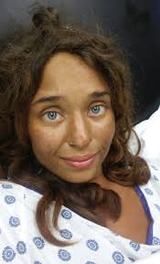 Norwegian girl survives eagle abduction