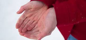 Image result for Frostbite