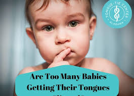 The tongue tie is located at the base of the tongue halfway to the salivary duct. Are Too Many Babies Getting Their Tongues Clipped The Real Story Alabama Tongue Tie Center Dr Richard Baxter Birmingham Al
