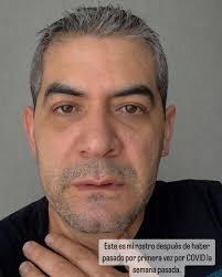 Dr. Javier Garnica (@drjaviergarnica) · Instagram 照片和视频