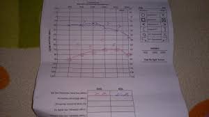Check spelling or type a new query. Odyometri Testinizi Bu Konuda Paylasip Yorum Alabilirsiniz 6 Sayfa