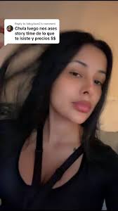 Replying to @fabyylove2 mi dr se llama dr shah y es el mejor👨🏻‍⚕️👊🏼@Dr.  Shah plastic and derm @Plastics and Dermatology  #abdonimoplastia#informacionquecura ...