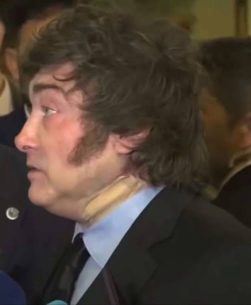 &eth;&uml; MILEI APARECI&Oacute; CON UNA VENDA EN EL CUELLO EN MADRID Y GENER&Oacute;  PREOCUPACI&Oacute;N EN REDES &eth; @LucaRomero: "Las im&aacute;genes de su rostro invitan a  hacerse la pregunta: &iquest;est&aacute; bien el Presidente? &iquest;