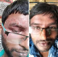 Dr. Jay Jain in Ashish Nagar,Indore