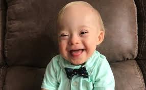 New Gerber Baby Lucas Warren Is First With Down Syndrome Down Syndrome Baby Gerber Baby Baby Contest