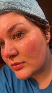 Hey All! Any tips or product recommendations for this? My pores look like  creaves and craters and I hateeeee it! I know nothing will completely get  rid of them but looking for