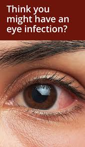 How To Tell If You Have An Eye Infection Eye Infections Bacterial Eye Infection Eye Infection Symptoms