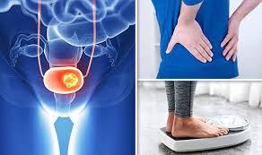 Don't let this throw you off. Lower Back Pain Cancer Woman Cancerwalls