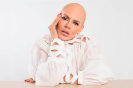 En horas de la madrugada de este sábado 31 de julio, falleció la animadora venezolana josemith bermúdez, quien ha documentado su larga y admirable lucha cont. El Estimulo Josemith Bermudez La Tenaz Lucha Por Reinventar La Vida Y Seguir La Funcion